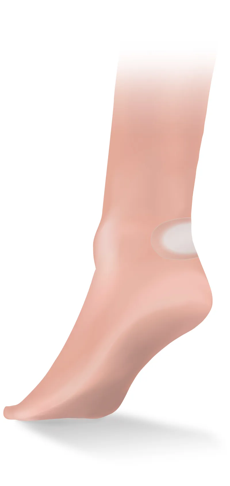 Lifesystems Sterile Blister Plasters - 6-pack-5